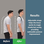 ComfyBrace Posture Corrector for Men and Women, Back Brace Straightener | Breathable adjustable posture brace, shoulder brace straps and upper back support for neck hump, hunchback, clavicle pain