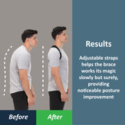 ComfyBrace Posture Corrector for Men and Women, Back Brace Straightener | Breathable adjustable posture brace, shoulder brace straps and upper back support for neck hump, hunchback, clavicle pain